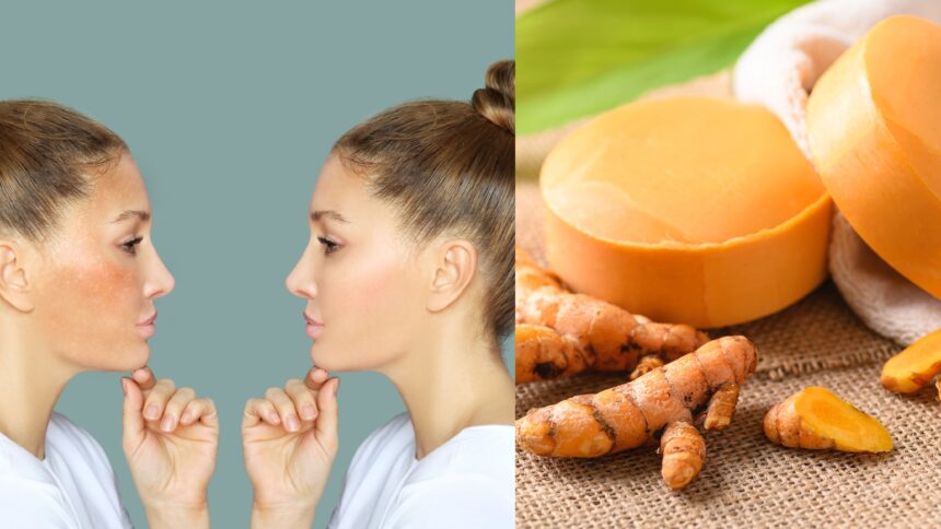 Does Turmeric Soap Lighten Skin