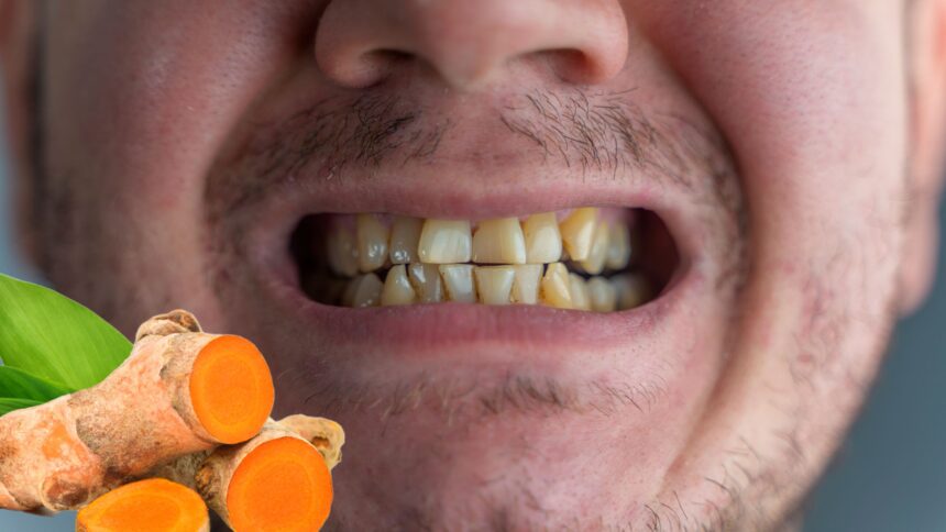 Does Turmeric Stain the Teeth?